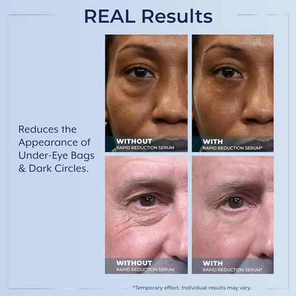 Plexaderm Rapid Reduction Eye Serum - Visibly Reduces Under-Eye Bags