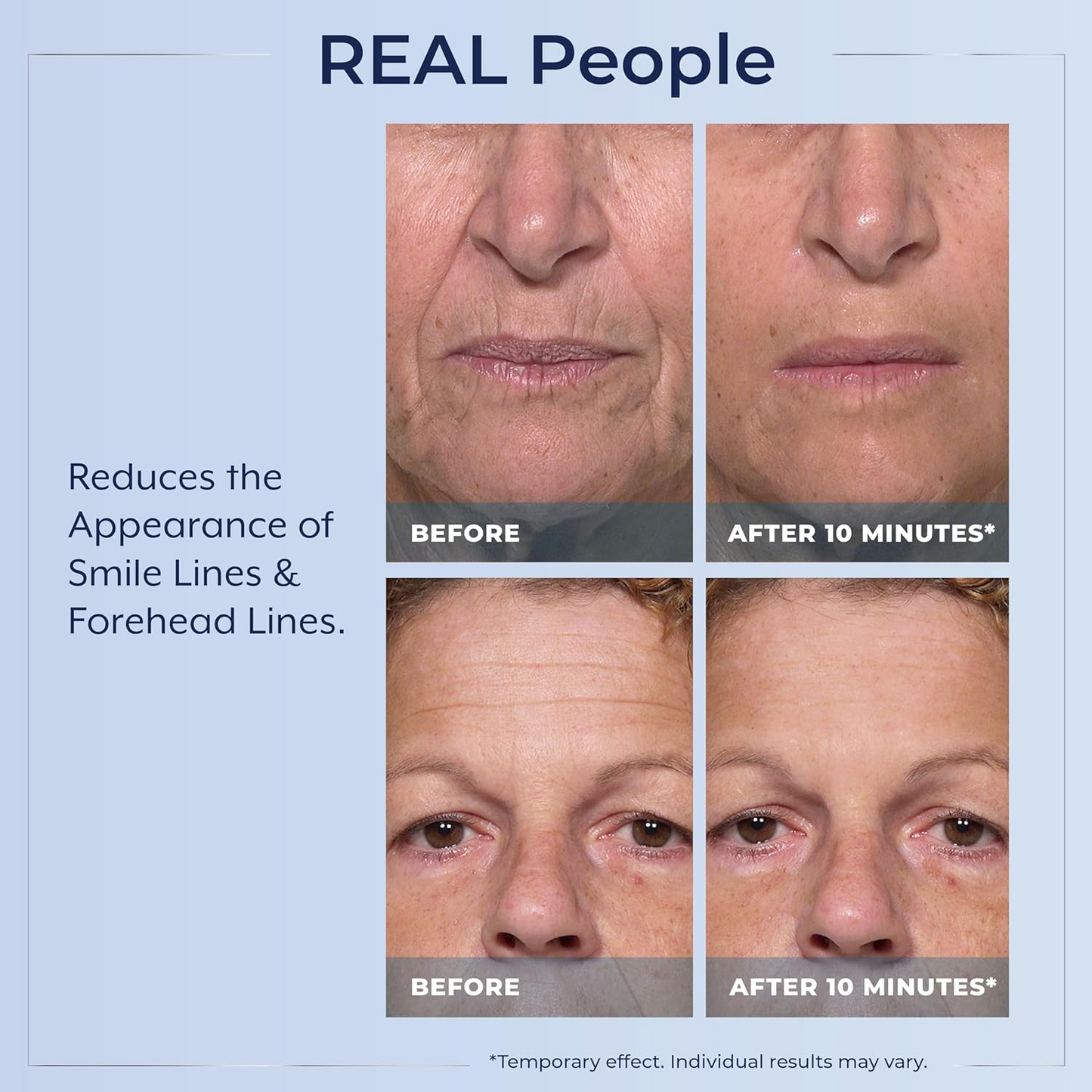 Plexaderm Rapid Reduction Eye Serum - Visibly Reduces Under-Eye Bags