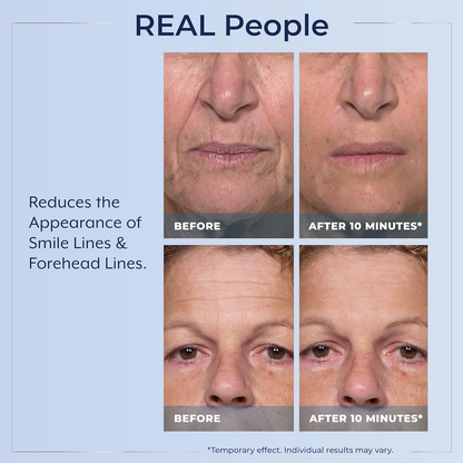 Plexaderm Rapid Reduction Eye Serum - Visibly Reduces Under-Eye Bags