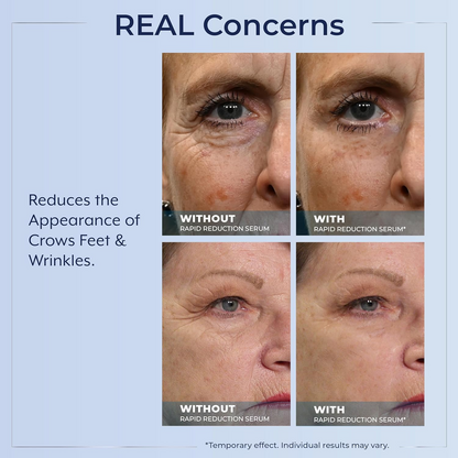 Plexaderm Rapid Reduction Eye Serum - Visibly Reduces Under-Eye Bags